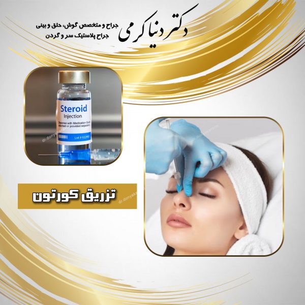 تزریق کورتون