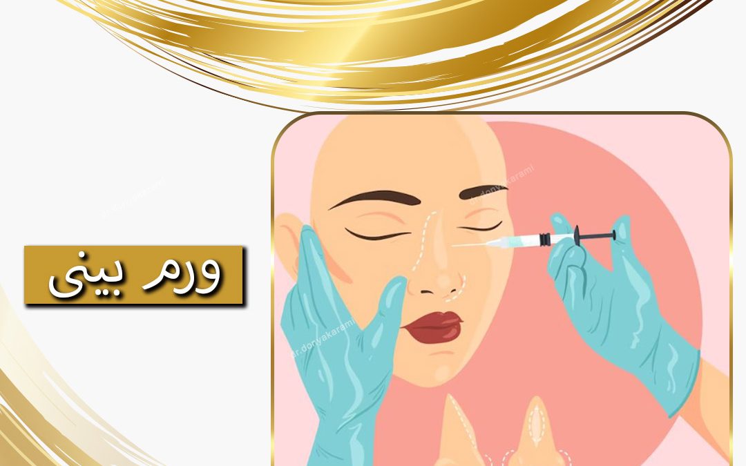 ورم بینی بعد از عمل