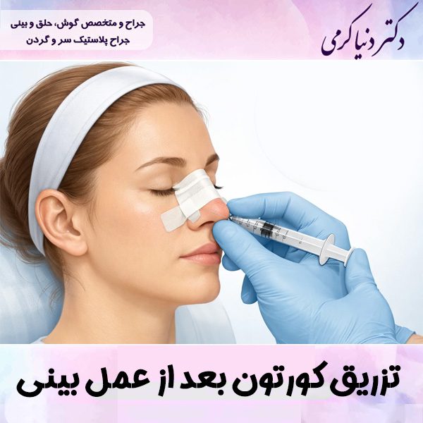 تزریق کورتون بعد از عمل بینی