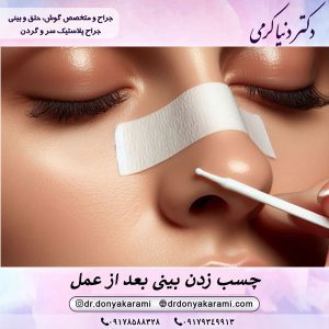 چسب زدن بینی بعد از عمل | دکتر دنیا کرمی