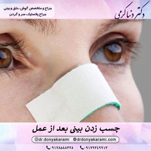 چسب زدن بینی بعد از عمل | دکتر دنیا کرمی