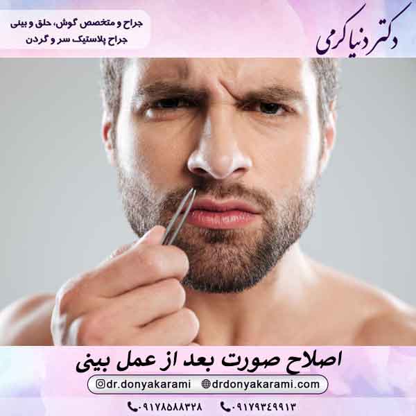 اصلاح صورت بعد از عمل بینی