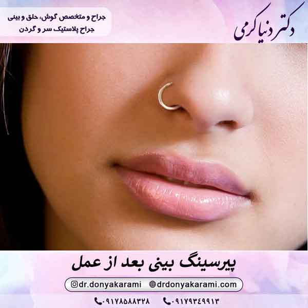 پیرسینگ بینی بعد از عمل
