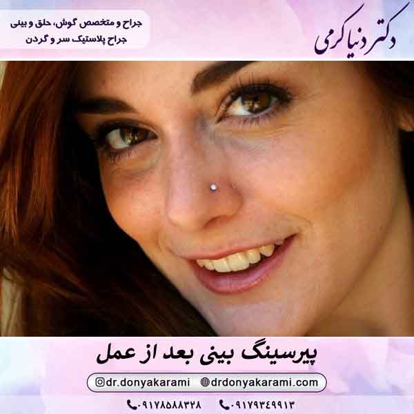پیرسینگ بعد از جراحی بینی