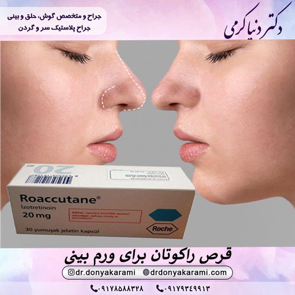 قرص راکوتان برای ورم بینی