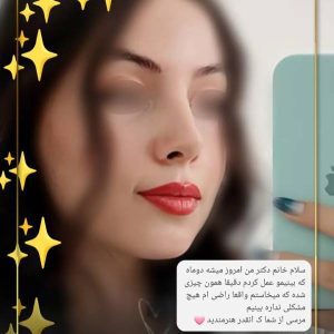 عکس نمونه کار بهترین جراح بینی شیراز