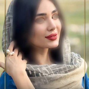 عکس نمونه کار بهترین جراح بینی شیراز