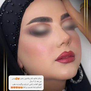 عکس نمونه کار بهترین جراح بینی شیراز
