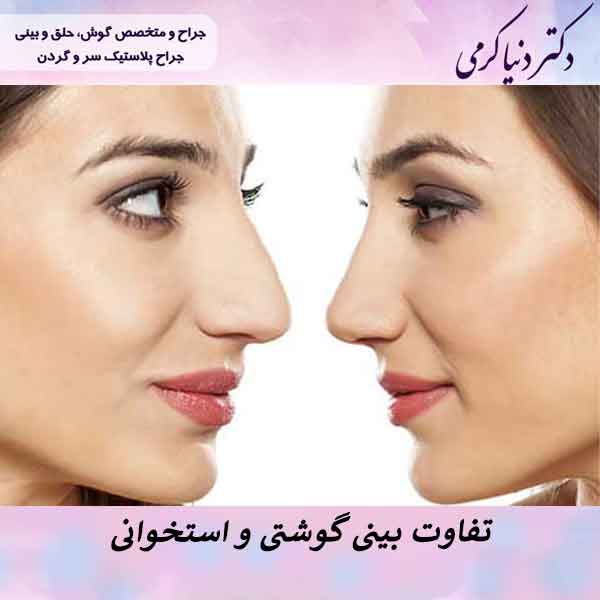 تفاوت بینی گوشتی و استخوانی چیست؟