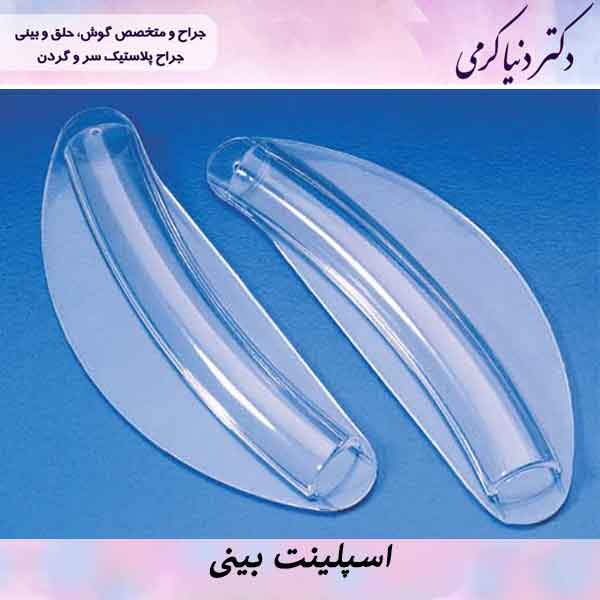 اسپلینت بینی چیست؟ | انواع اسپلینت بینی و کاربردها