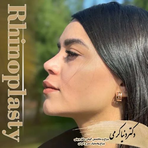 rhinoplasty-196