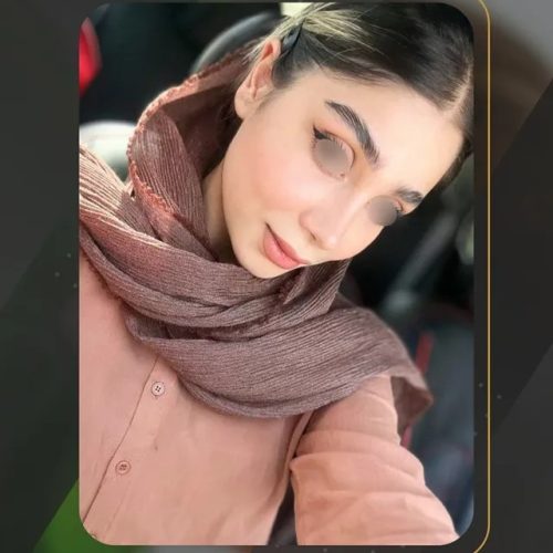rhinoplasty-208