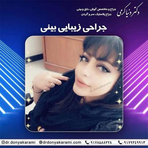 جراحی-بینی-10