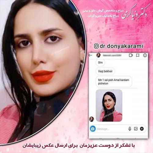 جراحی-بینی-11