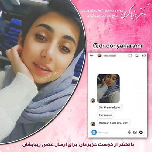 جراحی-بینی-13