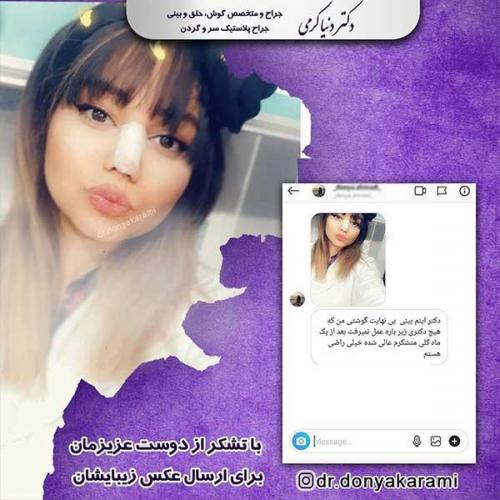 جراحی-بینی-16