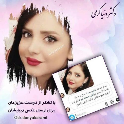 جراحی-بینی-18