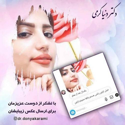 جراحی-بینی-19