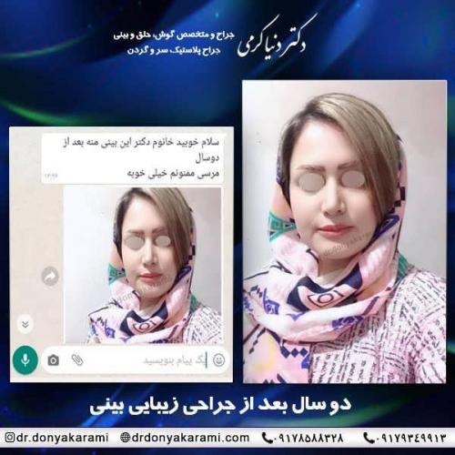 جراحی-بینی-21