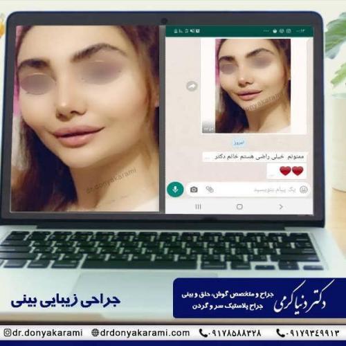 جراحی-بینی-26