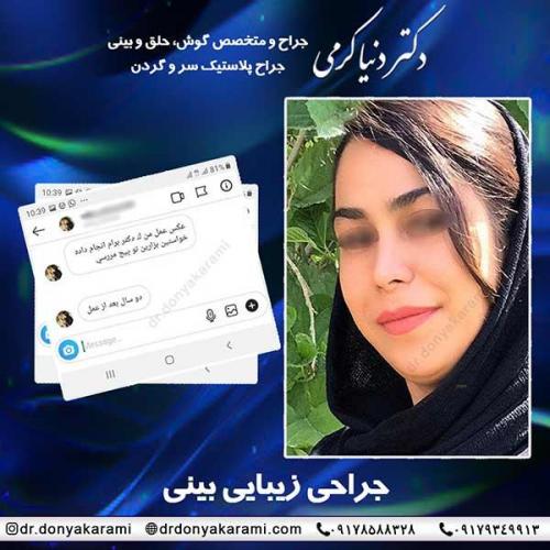 جراحی-بینی-45