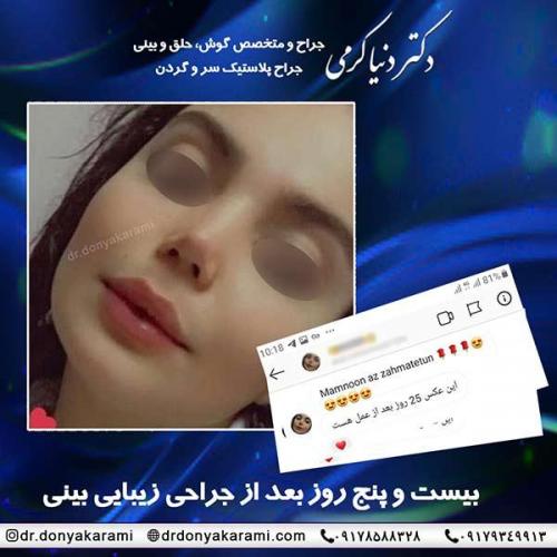 جراحی-بینی-47