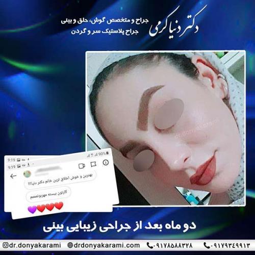 جراحی-بینی-49