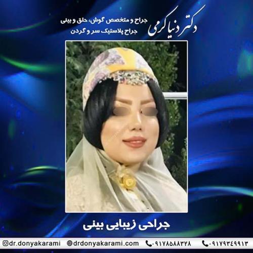 جراحی-بینی-55