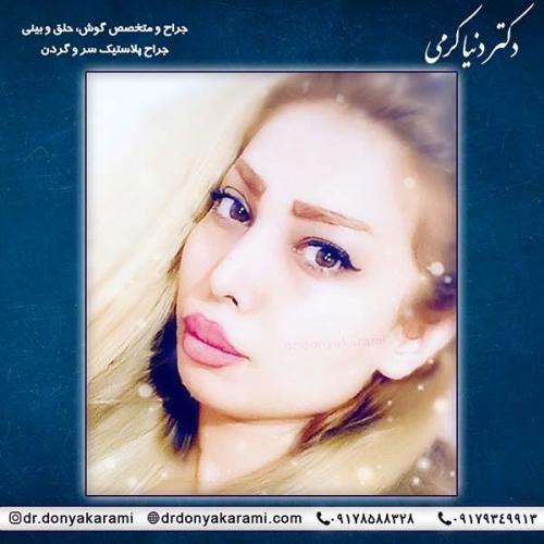 جراحی-بینی-7