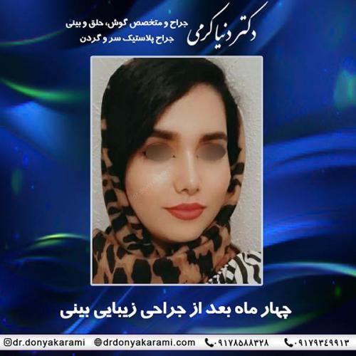 جراحی-بینی-71