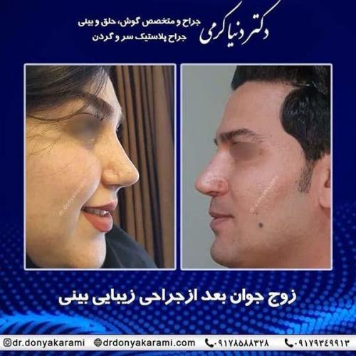 جراحی-بینی-84
