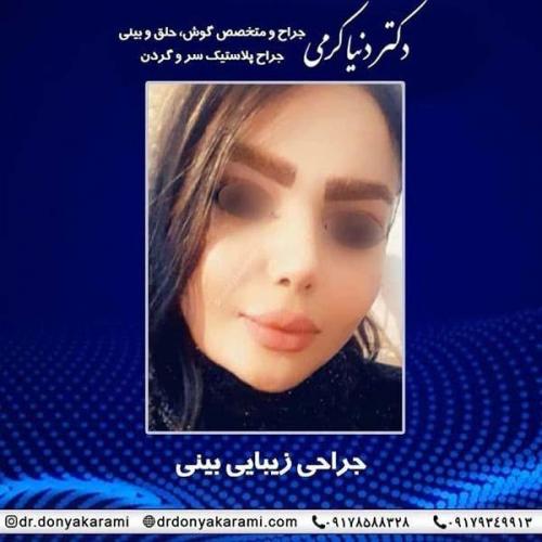 جراحی-بینی-87