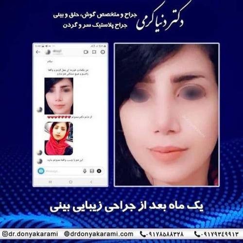 جراحی-بینی-88