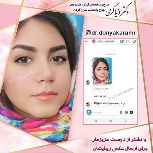 جراحی-بینی-9