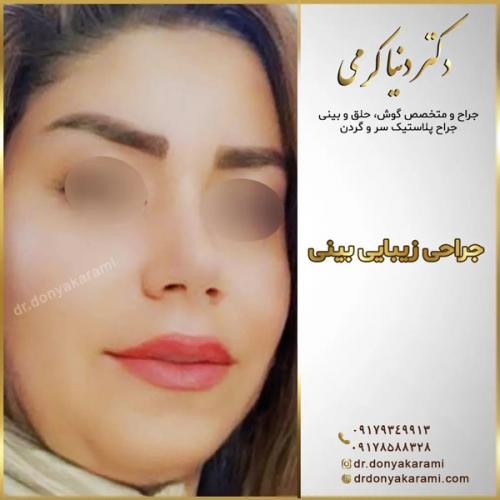 جراحی-بینی136