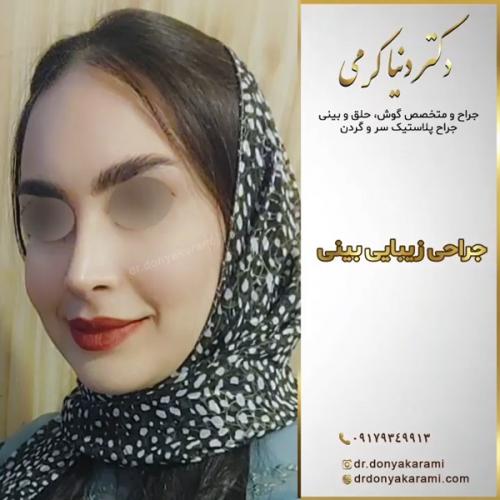 جراحی-بینی138