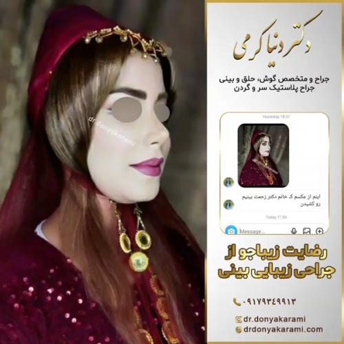 جراحی-بینی142