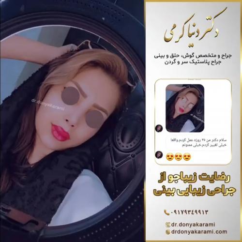 جراحی-بینی144