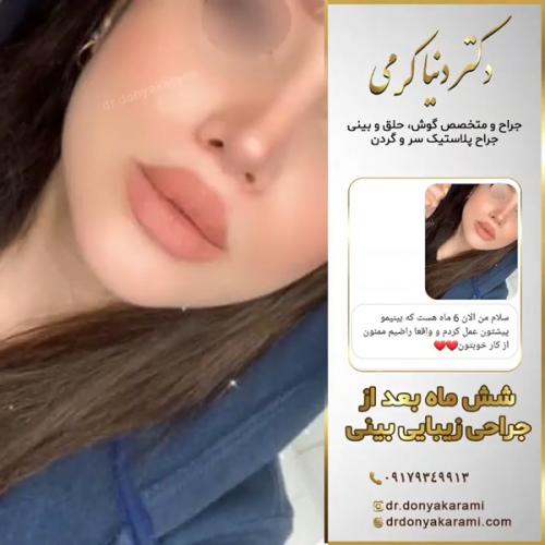 جراحی-بینی146