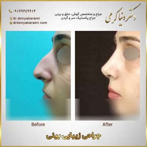 جراحی-بینی151
