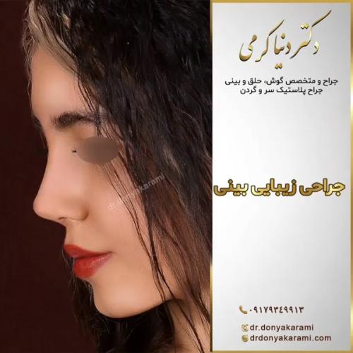 جراحی-بینی152