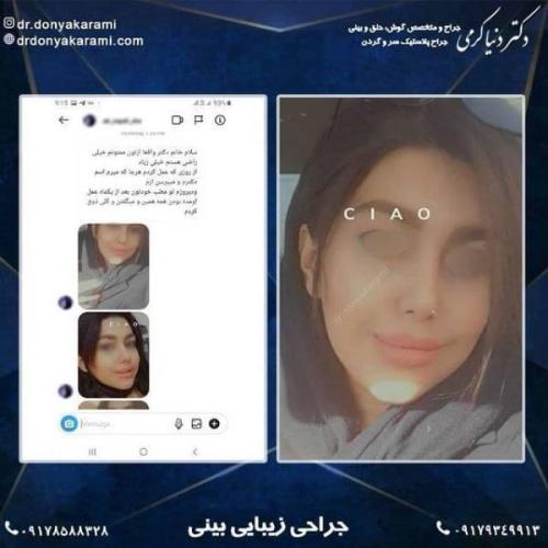 جراحی بینی 92 (3)